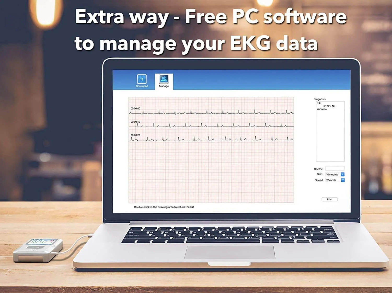 Portable EKG Monitoring Device (for iPhone & Android, Mac & Windows) | Personal EKG Heart Monitor to Track Heart Rate & Rhythm for Heart Performance
